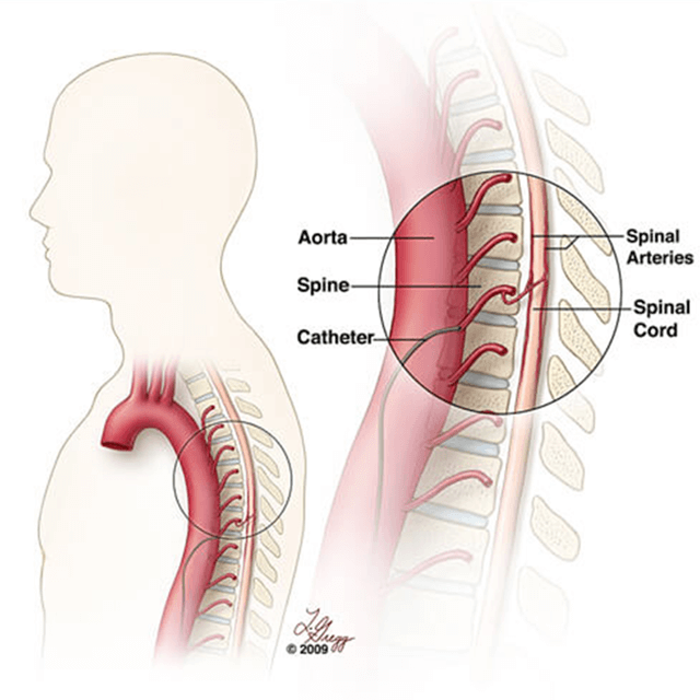 spine pathway side (1)