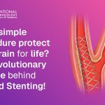 carotid stenting