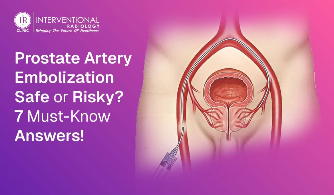 Prostate Artery Embolization