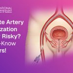 Prostate Artery Embolization